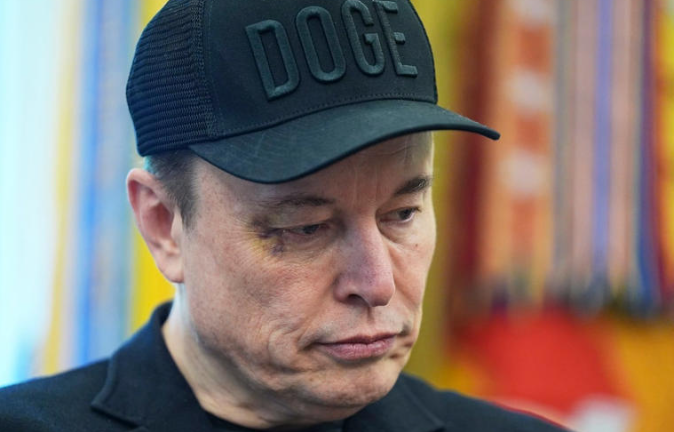 El ojo morado de Musk; "adelante, golpéame en la cara", le dijo a su hijo