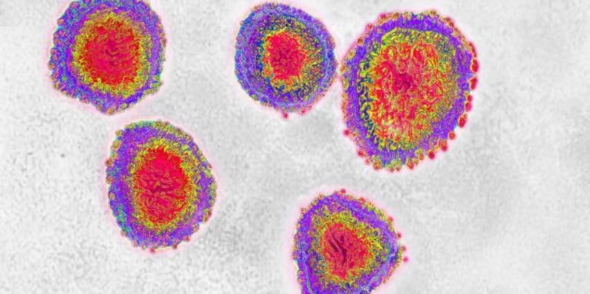 Coronavirus llega a América y EE.UU. registra el primer infectado
