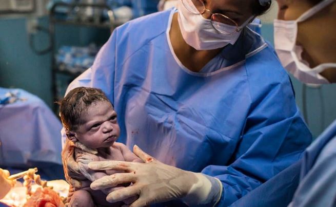Isabela, la bebé que se hizo viral por su peculiar gesto al nacer