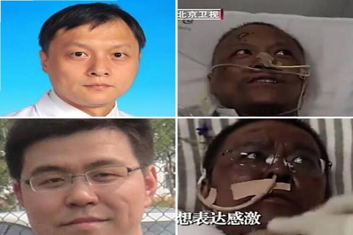 Médico con piel ennegrecida por Covid-19, 1a. muerte en China en semanas