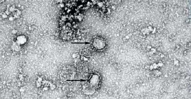 El coronavirus de Wuhan desde el microscopio