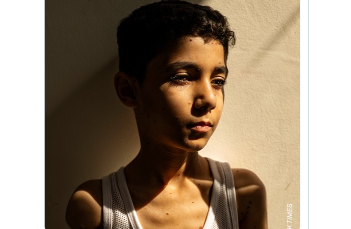 Retrato de niño palestino sin brazos gana 'Foto del Año' de World Press Photo