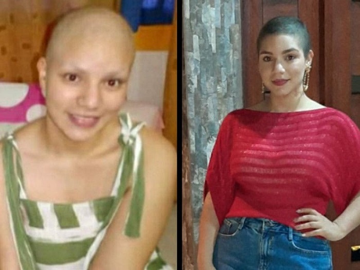 ‘El 2020 no es tan malo’; asegura joven de 25 años que venció el cáncer