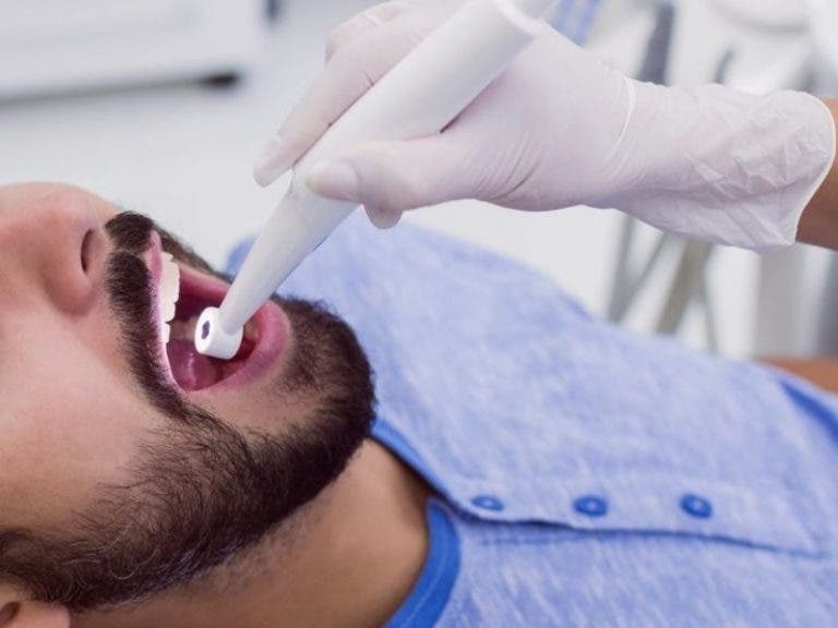 Hombre muere tras blanqueamiento dental y otros dos más entran en coma