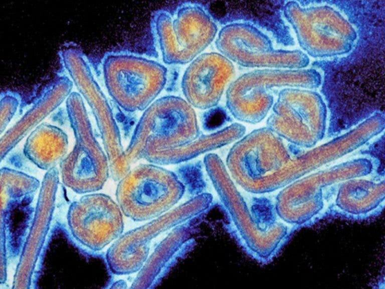 Chapare, un virus letal similar al Ébola reaparece ¿Cómo se contagia?