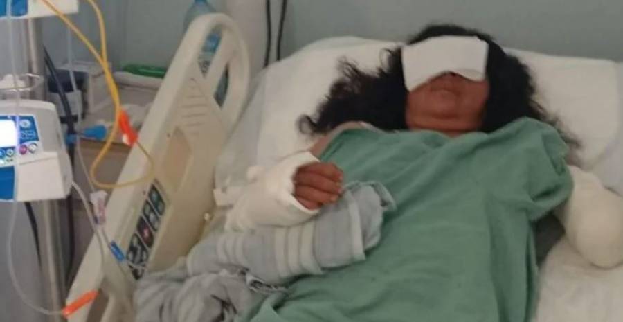 Oaxaca: Maratonista podría perder ambos brazos por ataque de perros