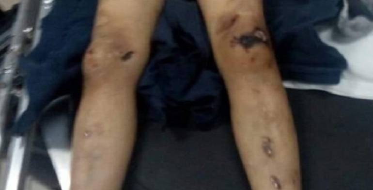 Mujer mata a martillazos a su hijo de 7 años en Guanajuato