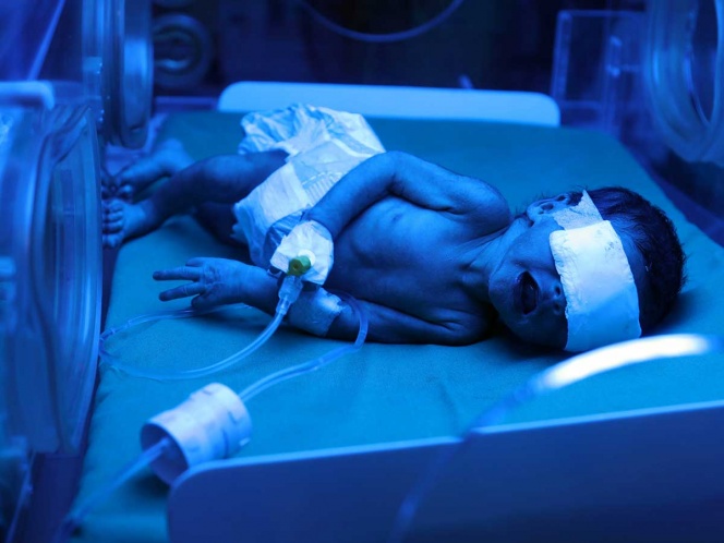 Médicos investigan caso de bebé que nació con anticuerpos contra COVID-19