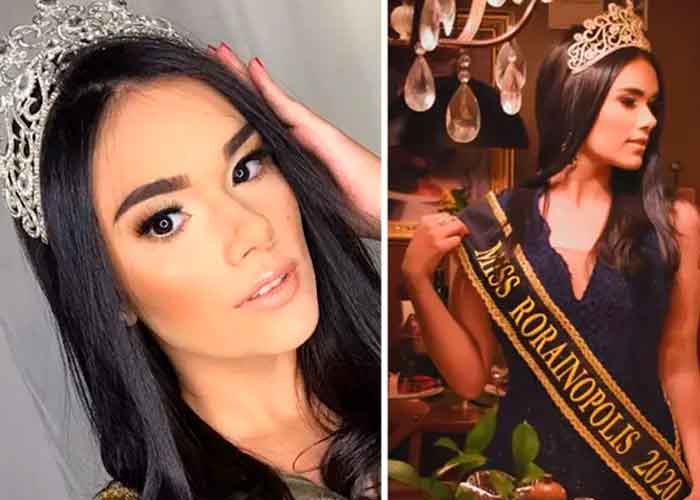 Reina de belleza de solo 21 años muere cuando la operaban de un tumor