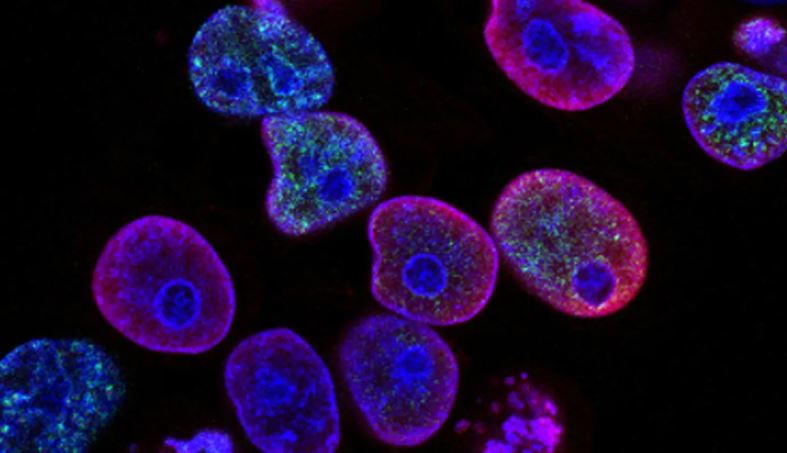 Estudio abre nuevas vías para fortalecer las células inmunitarias contra el cáncer