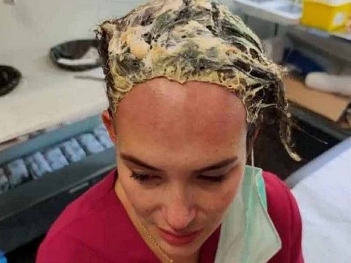 Colocan gorro con pegamento a una mujer y ésta pierde su cabello