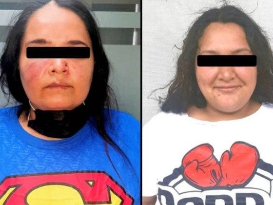 Por deuda de $60 pesos, mujeres lían a golpes y se tiran los dientes