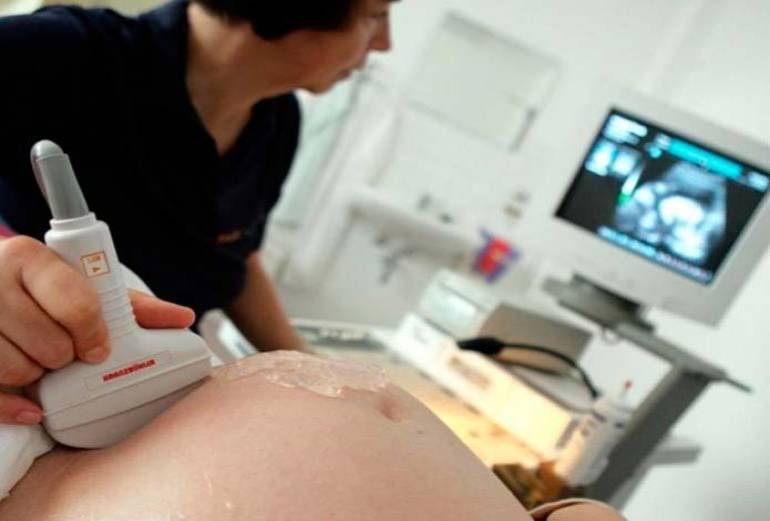 Mujer supo que estaba embarazada 45 minutos antes de parir en Escocia