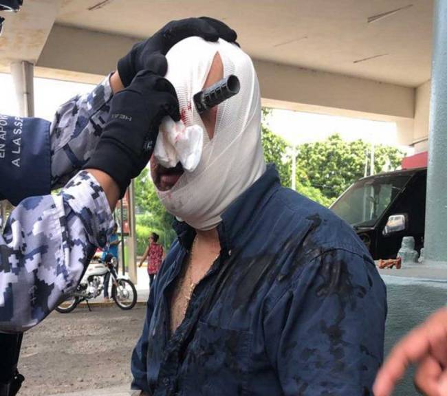 Termina con cuchillo en el ojo por pelea en plaza comercial de Veracruz