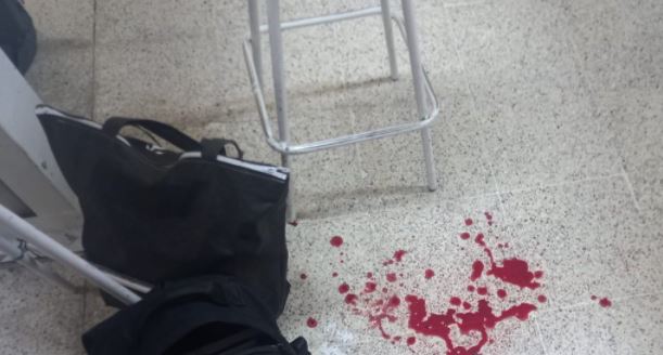 Estudiante jugaba con arma de fuego y se da un balazo en un dedo