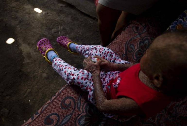 Niña crece con "piel de pescado", extraña enfermedad, en Nicaragua