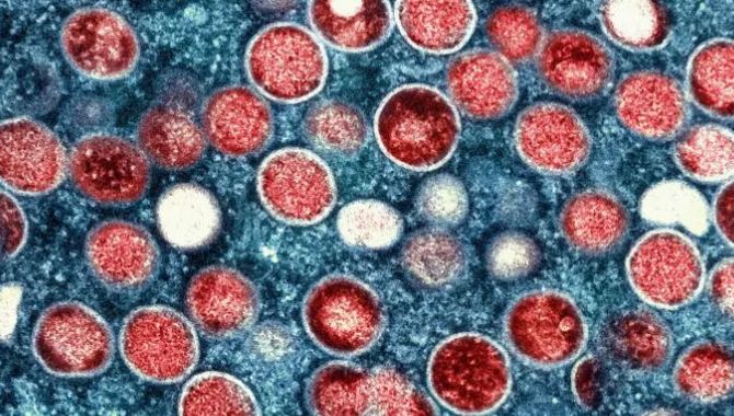 Disease X, la pandemia que podría ser peor que el COVID-19, según la OMS