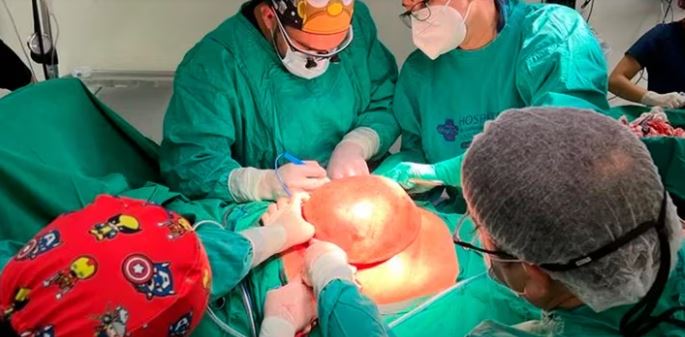 Chile: Más de 20 cirujanos operaron 11 horas a paciente para extirparle tumor de 4.2 kg