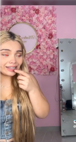 Influencer pide ayuda por pupilentes que le hicieron “perder la visión”