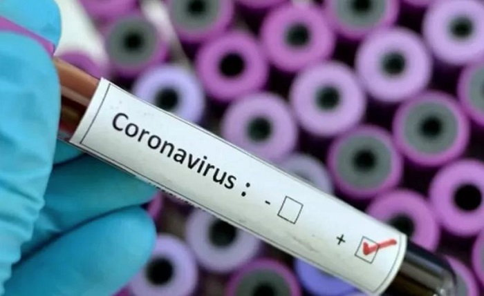 Yucatán: Hombre de 29 años, primer caso de coronavirus en Muxupip