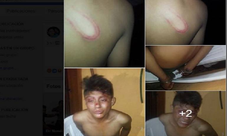 Denuncian abuso de policías de Cuzamá: estropean a un menor