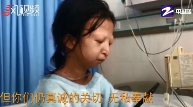 Fallece joven china que sólo comió arroz y chiles durante 5 años