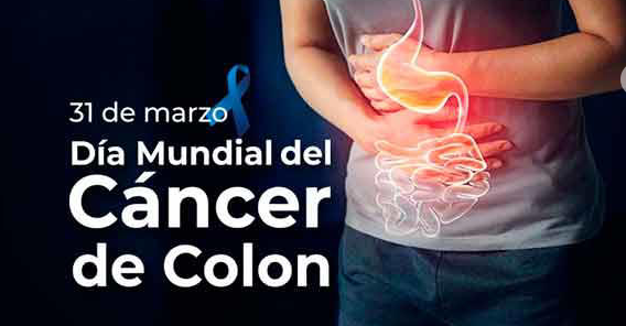 Incrementan en México casos de cáncer colorrectal en jóvenes: UNAM