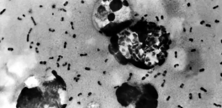 China confirma caso de peste negra; es tratable, pero preocupa que ocurra ahora