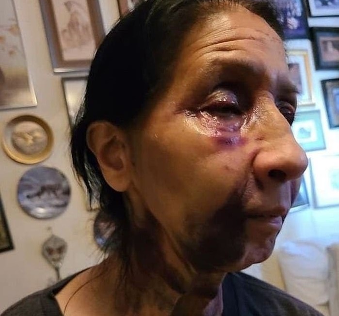 Jovencita de 23 años  golpea a abuelita y la deja con el rostro morado