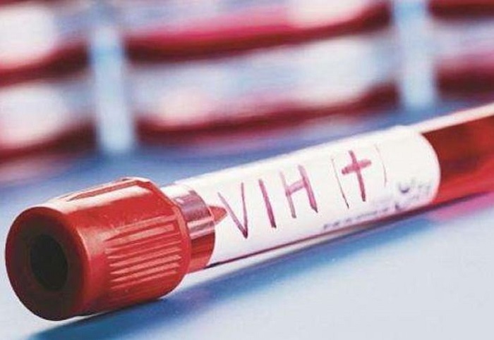 Yucatán ocupa el tercer lugar en casos de VIH en México