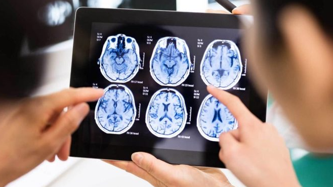 Conkaleña necesita cirugía por un tumor cerebral