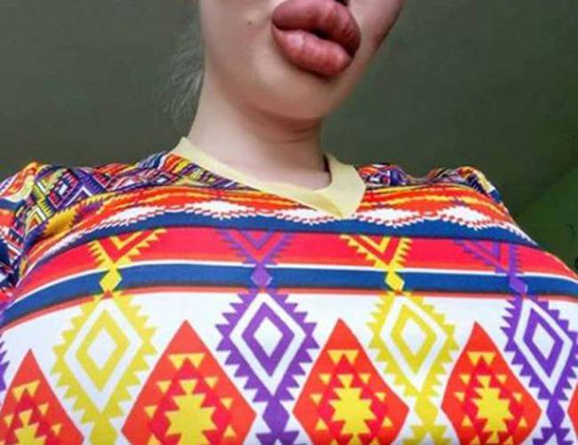 Conoce a la mujer con los labios más grandes del mundo