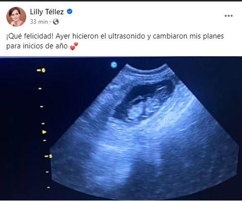 Lilly Téllez sorprende al decir que está embarazada
