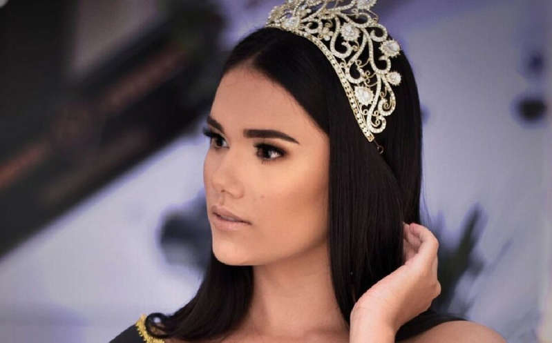 Luto en las pasarelas, fallece reina de belleza en Brasil