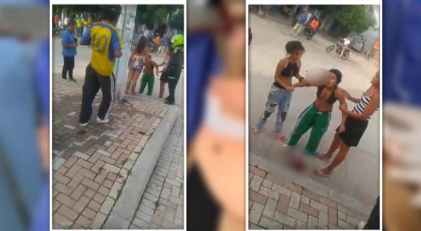 Colombia: Mujer termina con "machete" en la cabeza tras riña