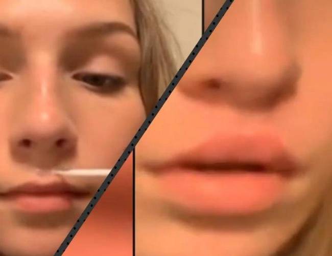 El nuevo reto viral para tener los labios más grandes