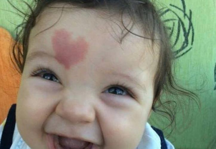 Bebé con marca roja de corazón cautiva las redes sociales